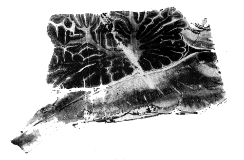 Sagittal section of the brain stem of apontile cat
