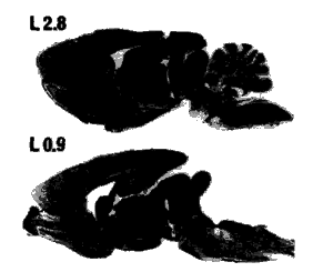 Photomicrograph of two sagittal sections